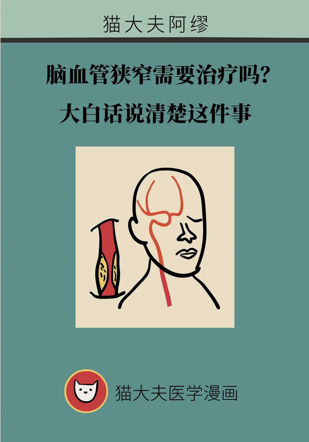 腦血管狹窄需要治療嗎？大白話說清楚這件事
