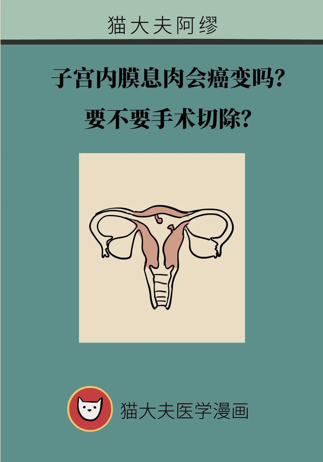 子宮內膜息肉會癌變嗎？要不要手術切除？