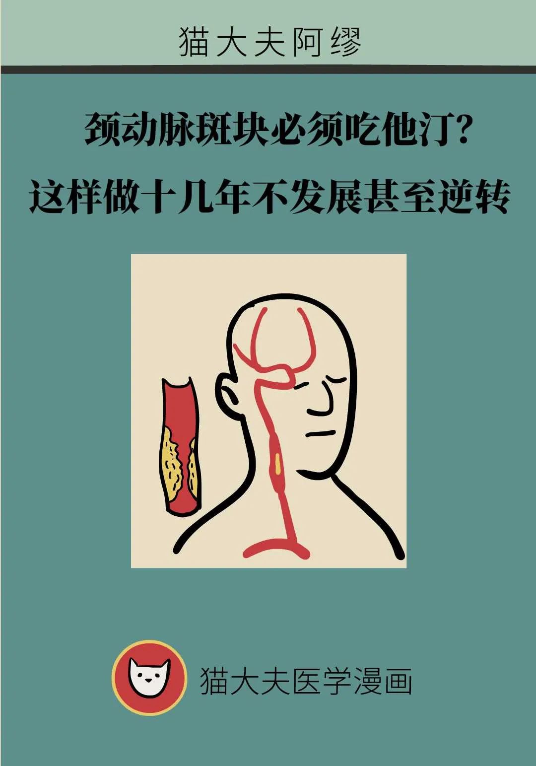 頸動脈斑塊必須吃他汀？這樣做十幾年不發展甚至逆轉