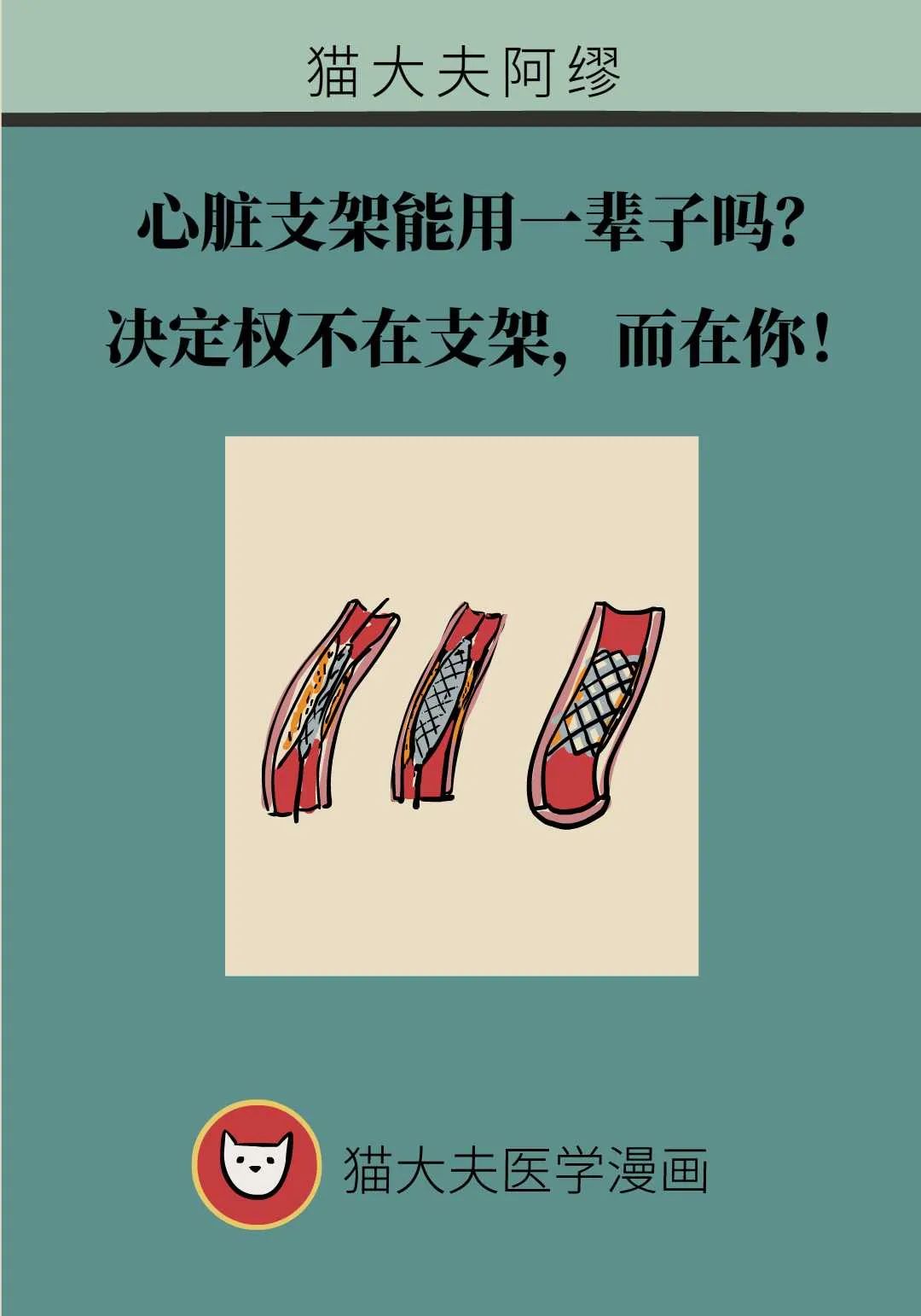 心臟支架能用一輩子嗎？決定權不在支架，而在你！