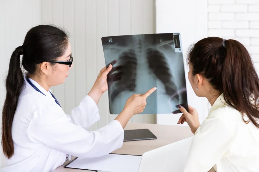在中國，為什麼不吸菸者中也有很多肺癌患者？|商周專欄