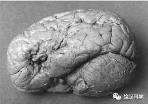 植物人是活還是死？兩篇｜死的難題；從未停止相信兒子還在的母親