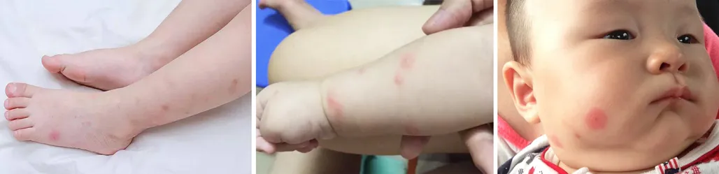 四代人的止癢傳家寶！蚊子包、犯困、汗臭一鍵清零