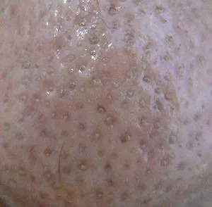 油皮比干皮老得慢？你們都被騙得好慘….