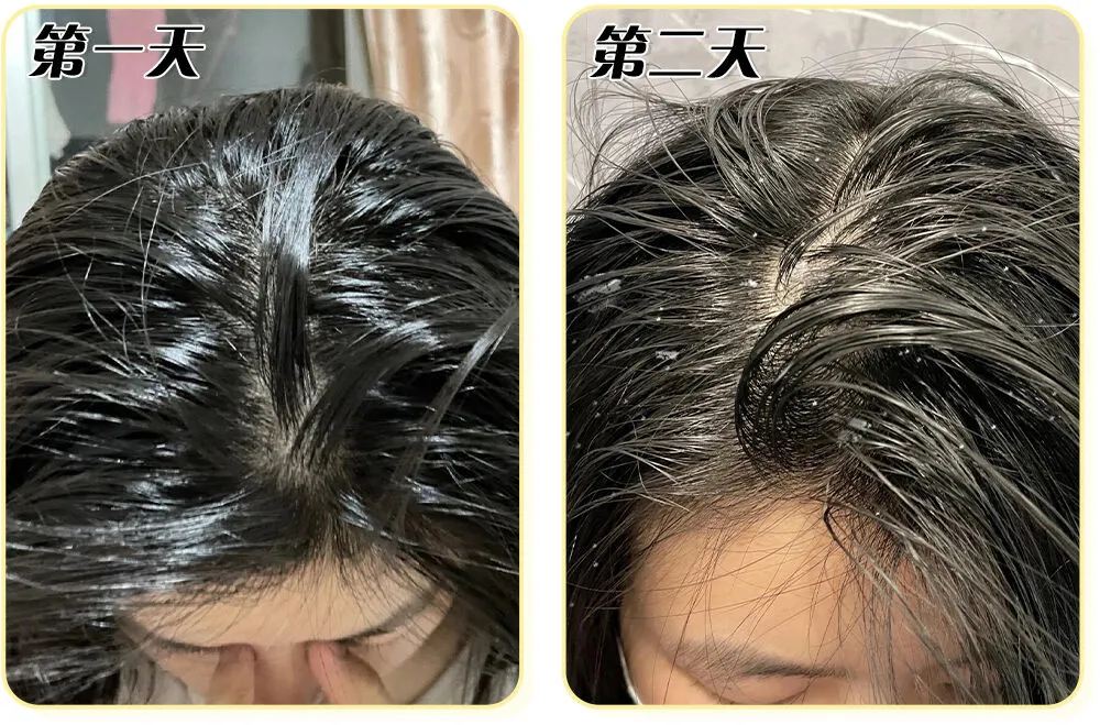 洗頭忽略這一點，頭油頭屑永遠都洗不乾淨！