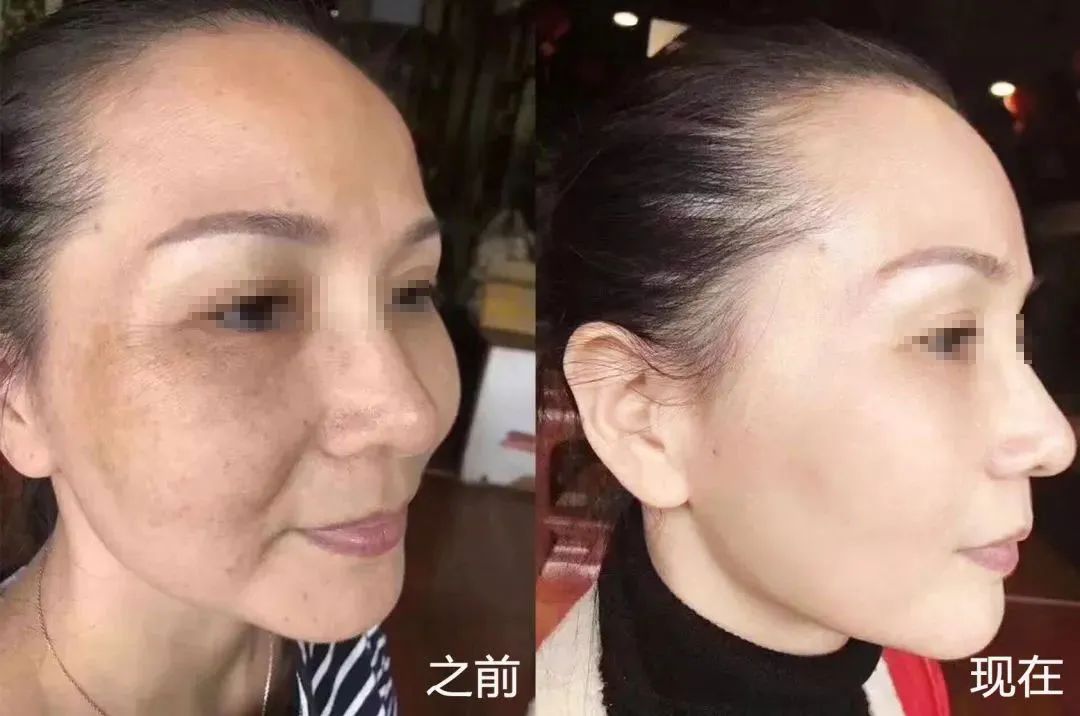 服了，上海40歲妻子在家自己“整容”，老公卻網上爆料：到底是什麼讓你這麼瘋狂！
