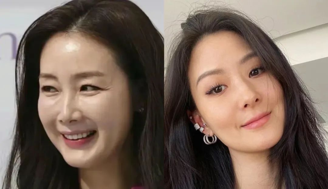 20年過去了，這對姐妹花整成了絕對反面…