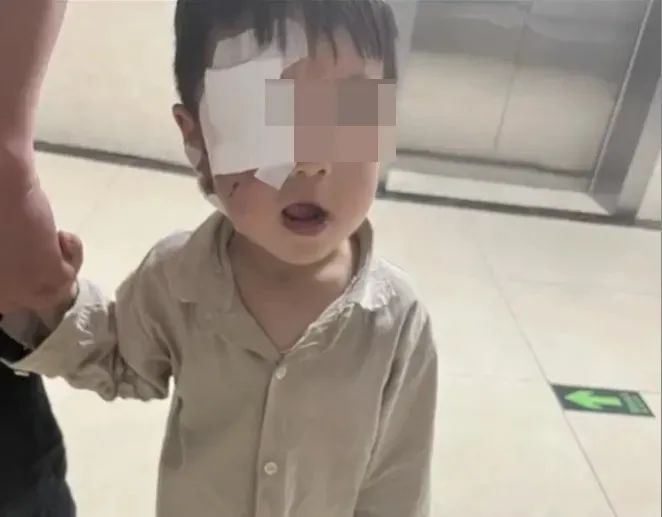 河南3歲男童被狗咬傷身亡：狗患背後，是人禍！