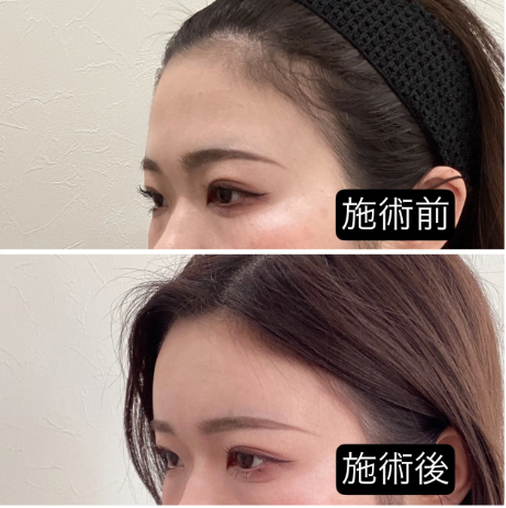 中國45歲女子無證開美容診所被捕！租了個公寓就敢開刀，導致客人爛臉化膿…