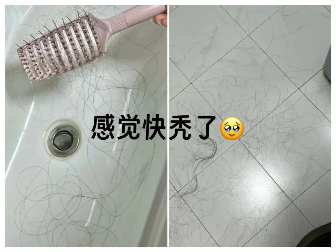 如果每天掉髮300根，那麼多久會變禿？