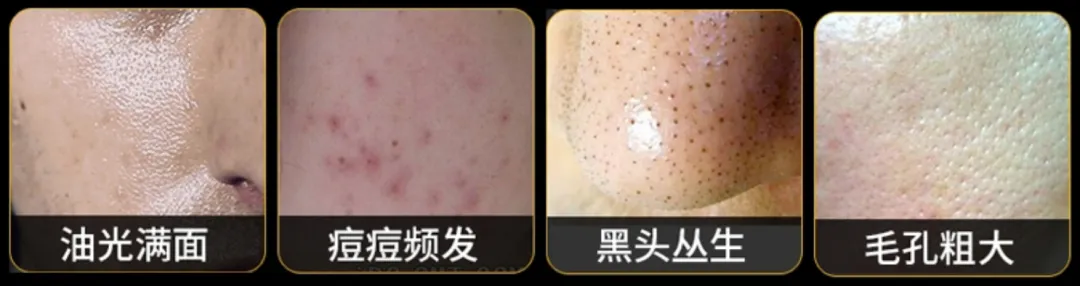 潔面屆“天花板”！深大港大博士聯名開發的洗面奶，​改善油痘，好沖洗，不殘留！