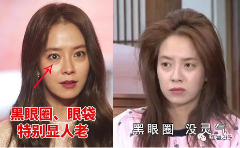 眼睛乾澀、疲勞、黑眼圈？5G時代“護眼利器”，輕輕一噴潤“視界”