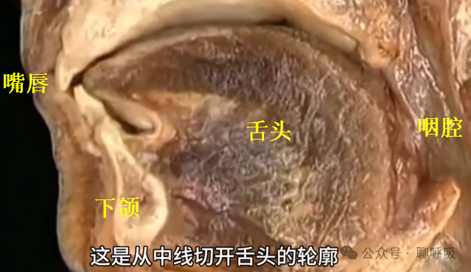 新的治療方法：舌下神經刺激法