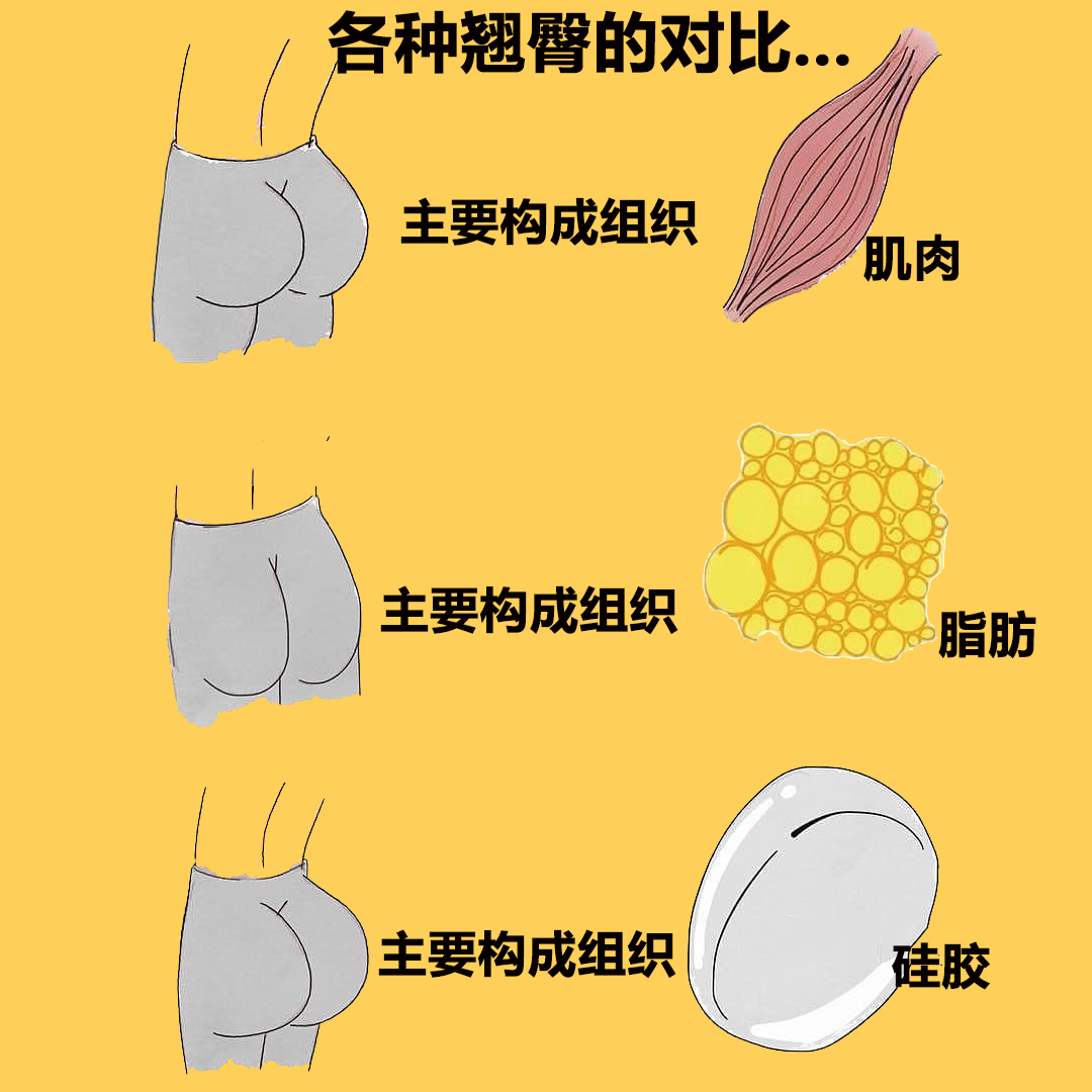 “翹臀”的三大型別，看看你是哪一種？