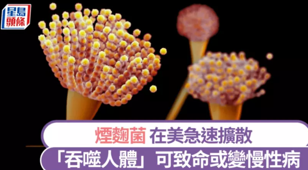 從肺部開始“吞噬”身體！“煙麴菌”真菌感染爆發，已擴散全美多州