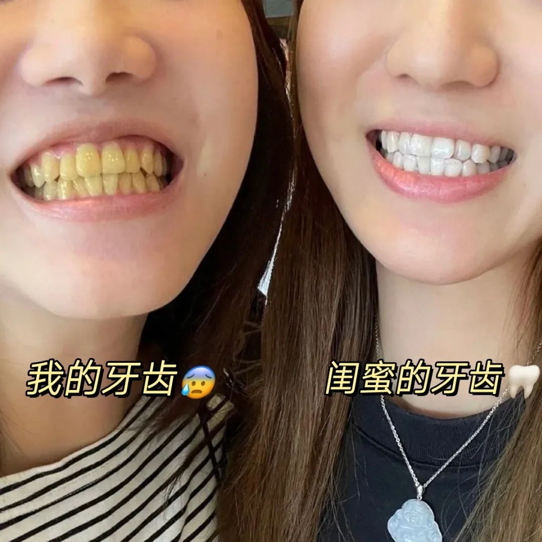 【過節不打烊】紐西蘭進口牙膏，趕走煙漬、牙垢、滿口飄香！