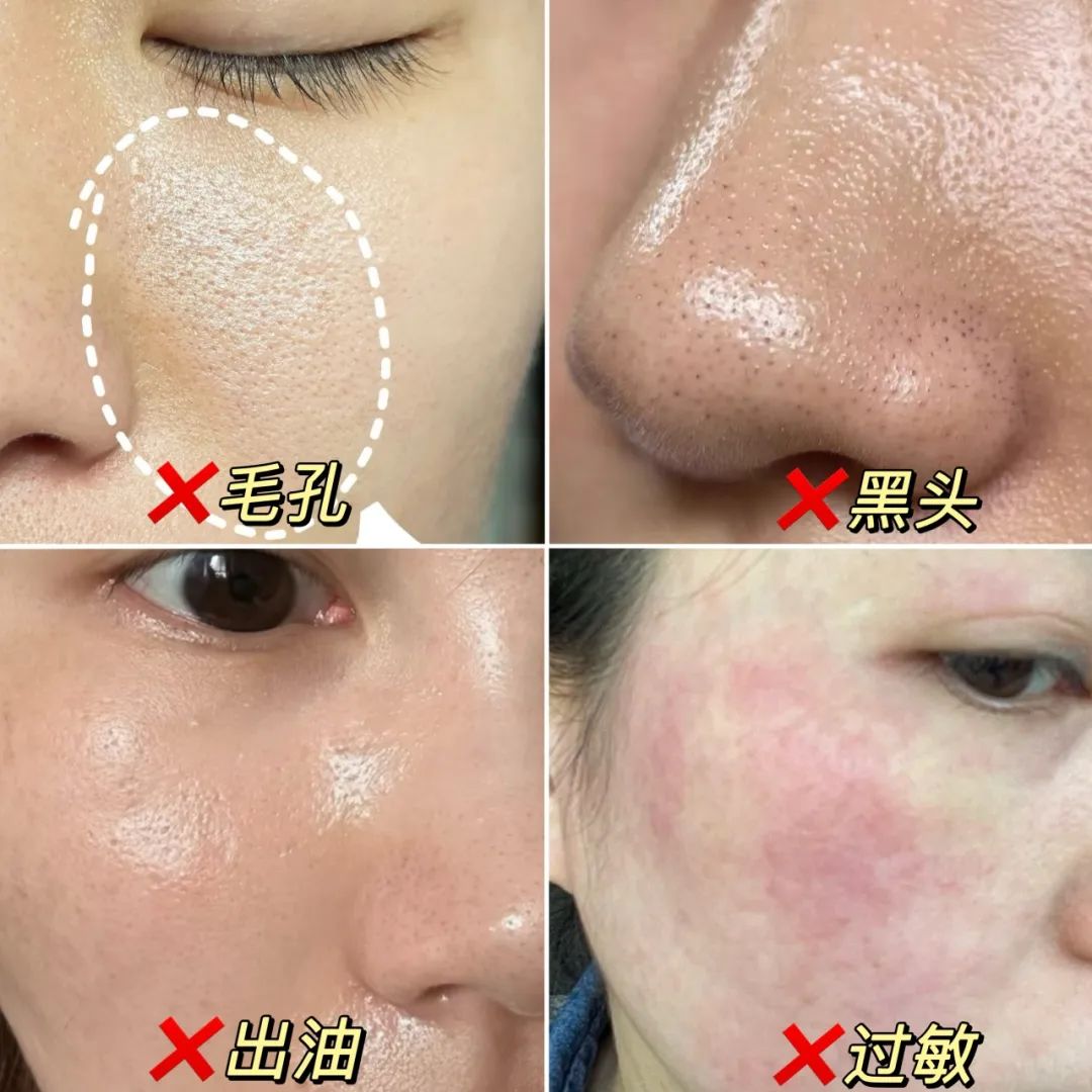 洗臉5分鐘，1小時就泛油？這瓶“養膚級潔面”讓臉清爽一整天！