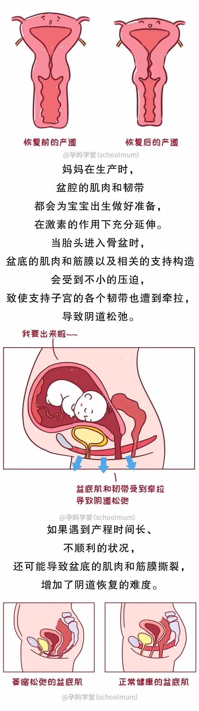 產後嫌棄你“松”的老公，請一腳踹飛！