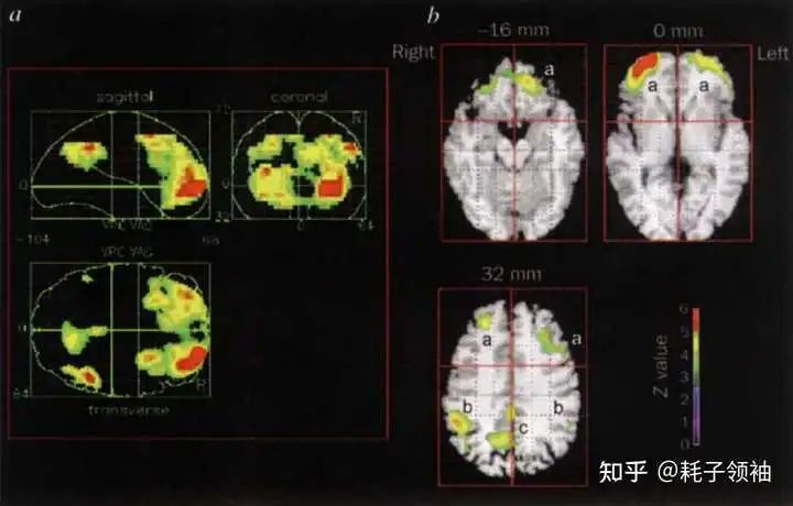 為什麼人在做夢時不會懷疑夢境裡的不合理之處？