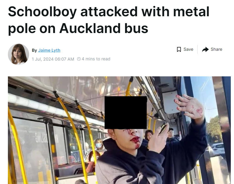 中國留學生公交車上遭歧視毆打！被1米鐵棍打掉5顆牙，司機卻放跑了施暴者……