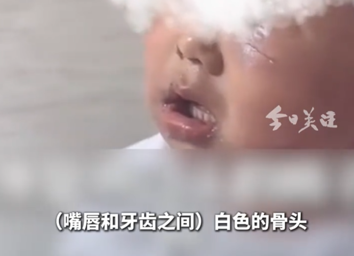 “多處撕裂，骨頭已露出！”醫生舉報3歲男童疑遭生父虐待！警方回應：已立案