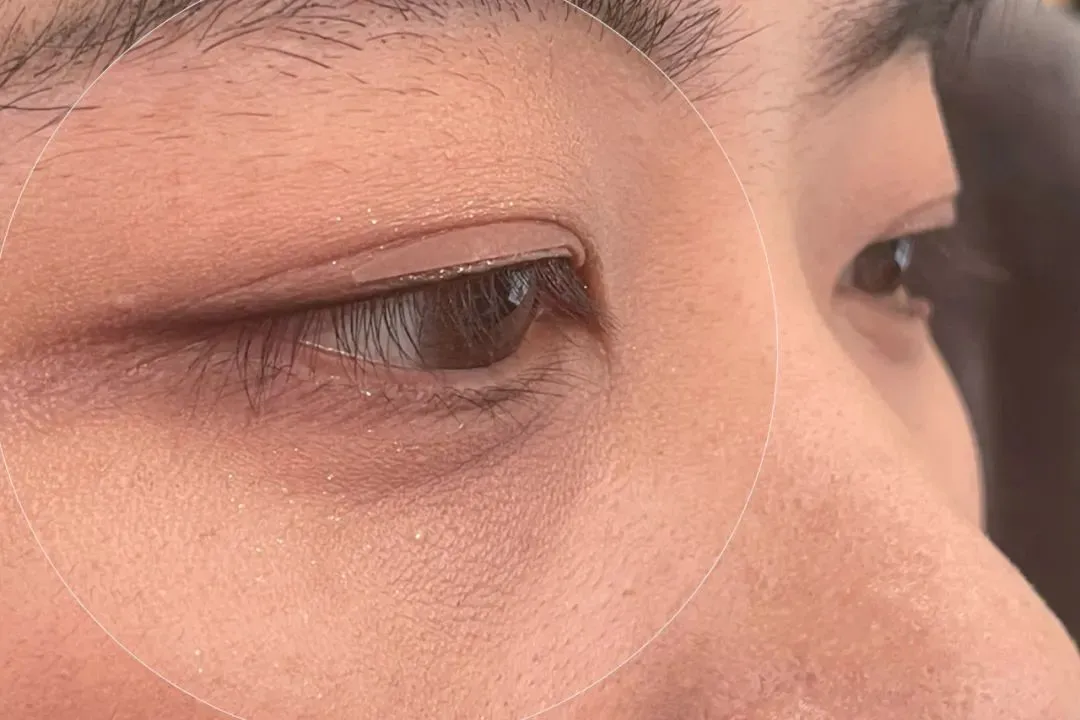 一個讓眼睛變好看的法子，真的很靠譜！