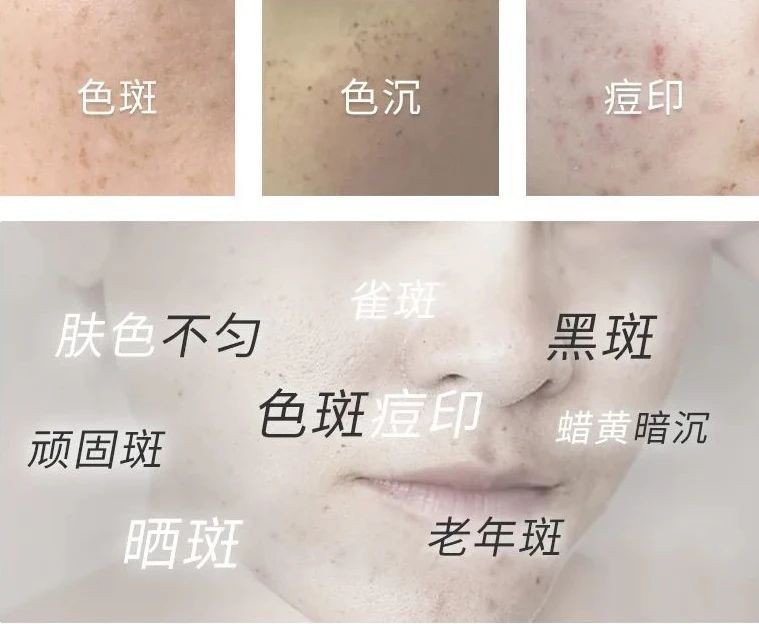 不愧是國貨之光！全新升級，1瓶不到60塊，用後斑點都消失了！