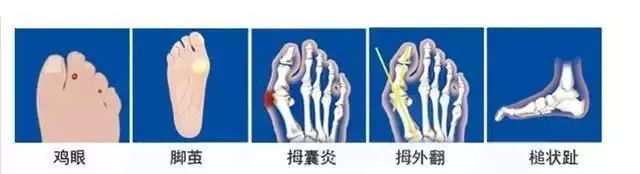 有啥輕到飛起，夏天穿賊好看，價格還低到離譜的鞋子？